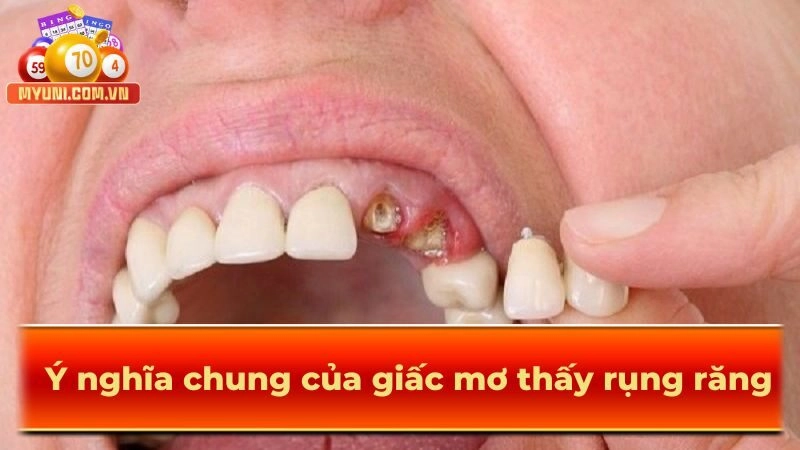 Y-nghia-chung-cua-giac-mo-thay-rung-rang-hien-nay